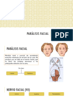 Parálisis Facial