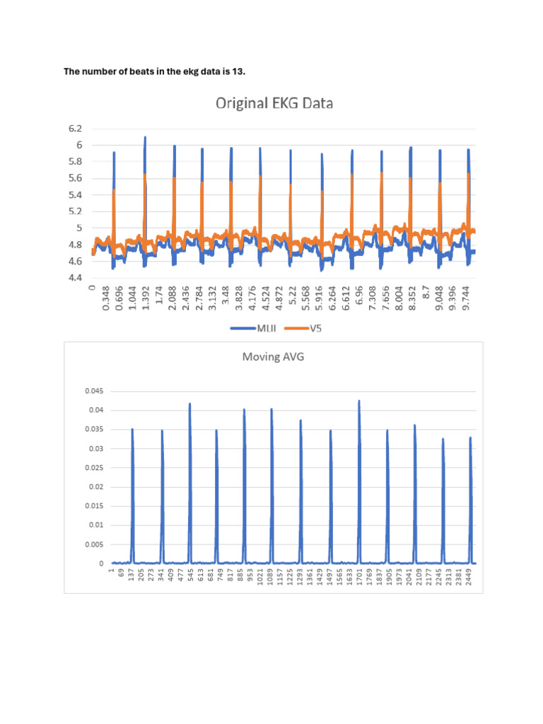 Ekgdata | PDF