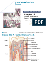 CH 25 Diseases of The GI Tract Summer Sem22!23!5368 88b1ee29aad