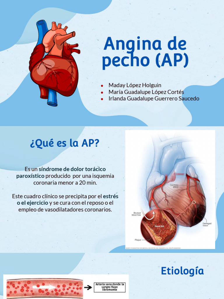 Angina de Pecho: Síntomas y Tratamiento | PDF | Fisiología | Angiología