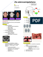 Hipertrofia Adenoamigdaliana