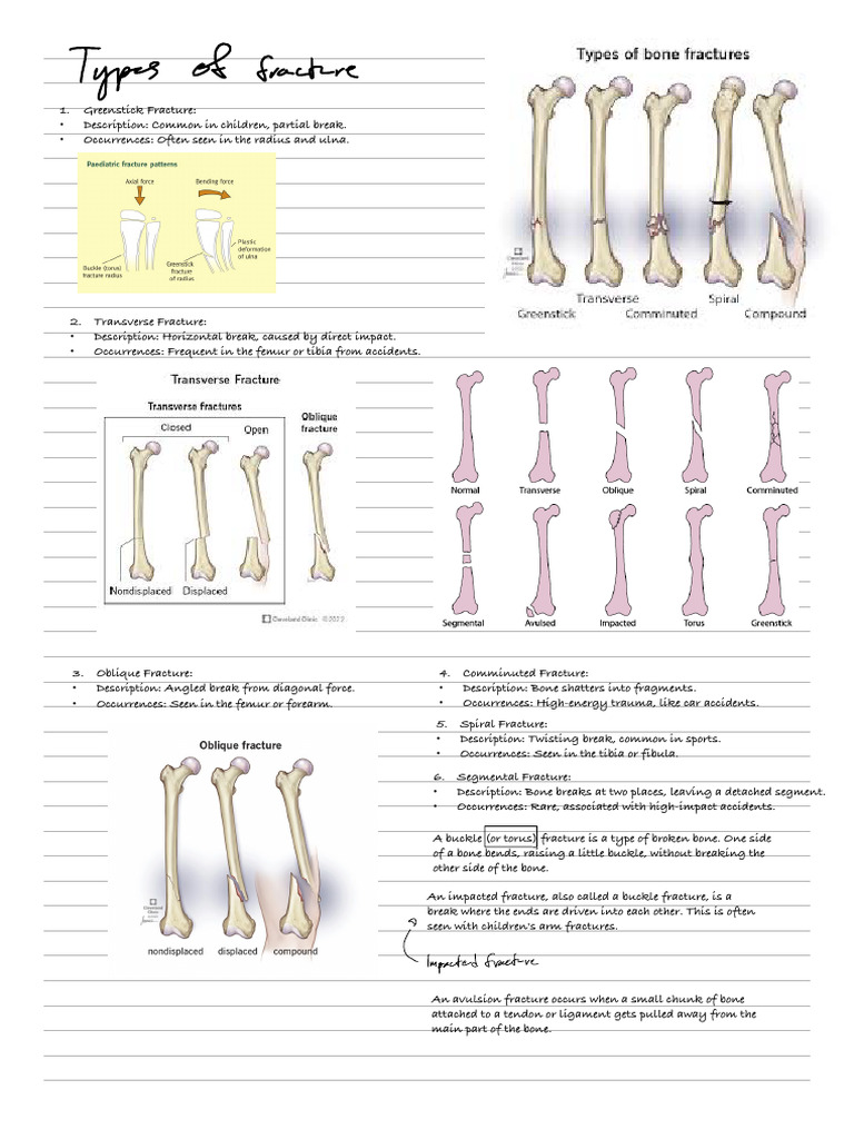 Fracture | PDF | Bone | Musculoskeletal System