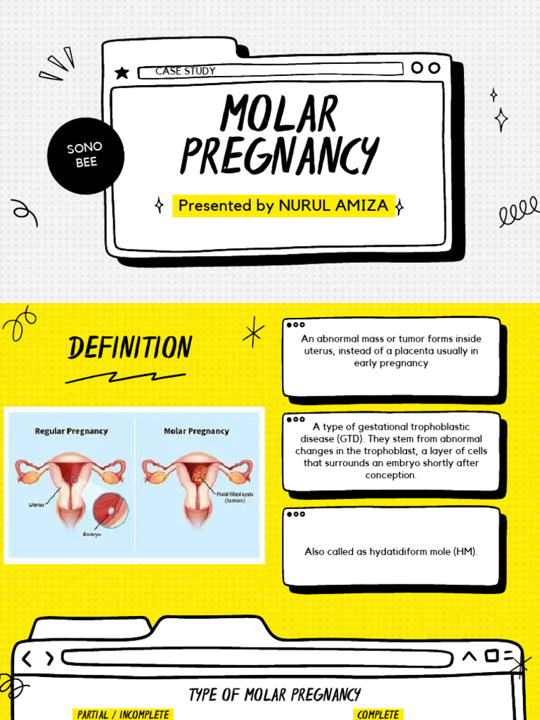 Molar Pregnancy | PDF | Pregnancy | Reproduction