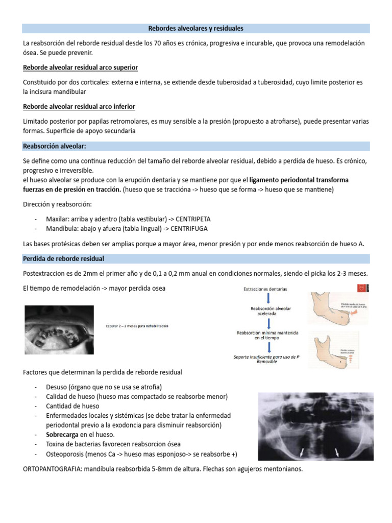 Reabsorción y Clasificación de Rebordes Alveolares | PDF | Hueso | Anatomía