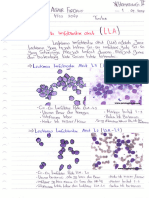 Muhammad Alfair Firdaus TGS Leukemia Lla Dan Lma Hematologi Ii