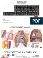 Toracotomia y Toracocentesis