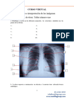 1.5.2. Taller Numero 1 Radiografia de Torax