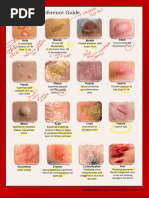Generalized and Localized Rashes - Lecturio | PDF | Dermatitis | Causes ...
