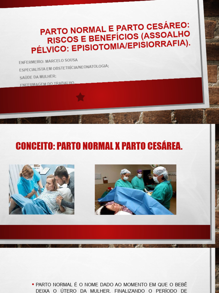 Parto Normal vs. Cesárea: Riscos e Benefícios | PDF | Parto | Cesariana