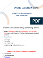 Ring Enhancing Lesions in Brain