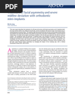 3° Midline Deviation Treatment Mechanics | PDF | Orthodontics ...