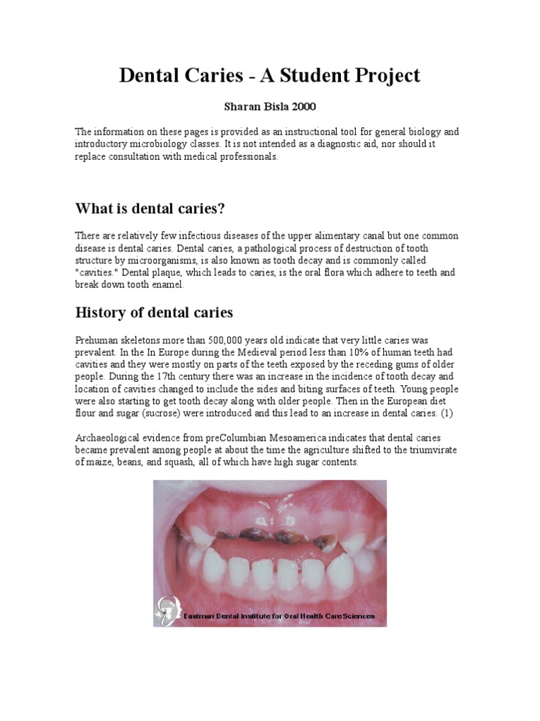Dental Caries Student Project | PDF | Human Tooth | Tooth Enamel
