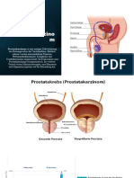 Prostata Presentation