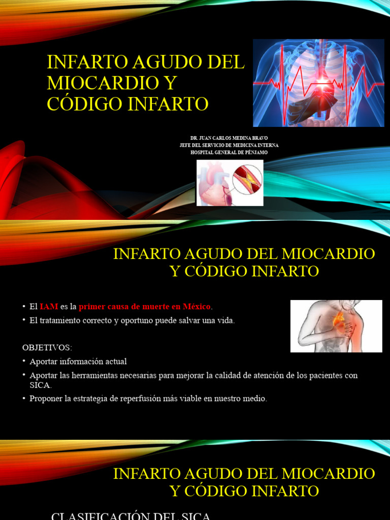 Infarto Agudo Del Miocardio y | PDF | Infarto de miocardio | Medicina