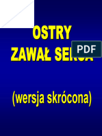Ostry Zawal Serca