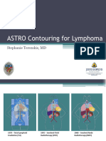 ASTRO Contouring For Lymphoma