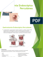 Gastrostomía Endoscópica Percutánea