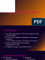 Tuberculosis en Pediatria