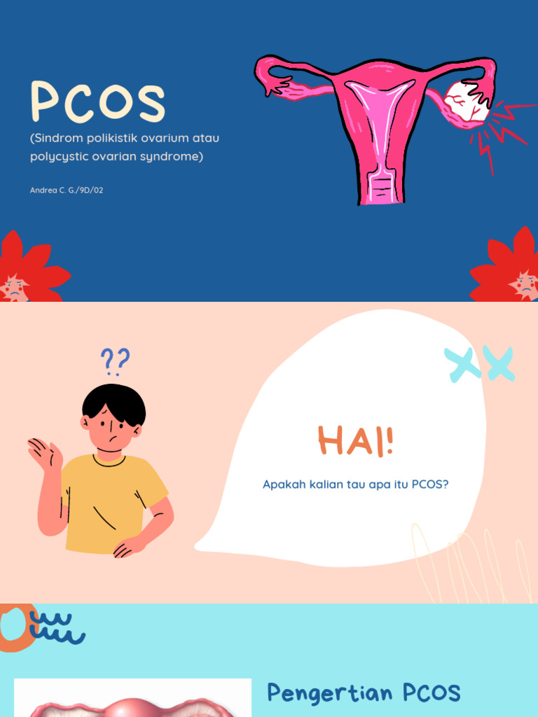 PPT POSTER PCOS ANDREA C 9D 02 | PDF