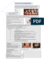 Dental Fluorosis: When Does Fluorosis Develop?