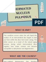 Herniated Nucleus Pulposus 1