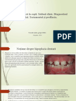 Hipoplazia Dentara