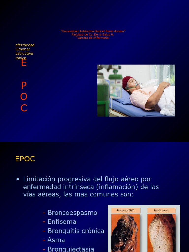EPOC - PPT 2023.ppt LIC. MARA | PDF | Tos | Asma