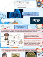 Histoplasmosis y Fiebre Del Valle