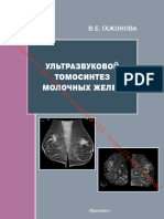 .ua.V.E.GAZHONOVA ULTRAZVUKOVOI TOMOSINTEZ MOLOCHNYKH ZHELEZ