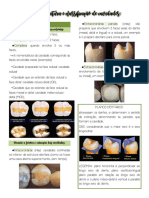 Nomenclatura e Classificação de Cavidades