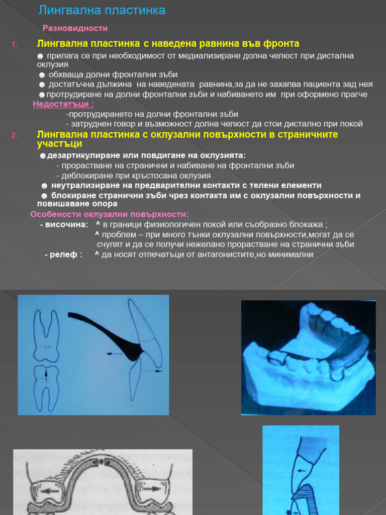 Lingual Plate Modification | PDF