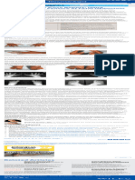 Rheumatology Case Report Hand Abnormalities Feat