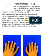 Atrial Septal Defects ( ASD)