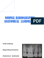 Mandibular Anatomical Landmarks in Radiology | PDF | Dental Anatomy ...
