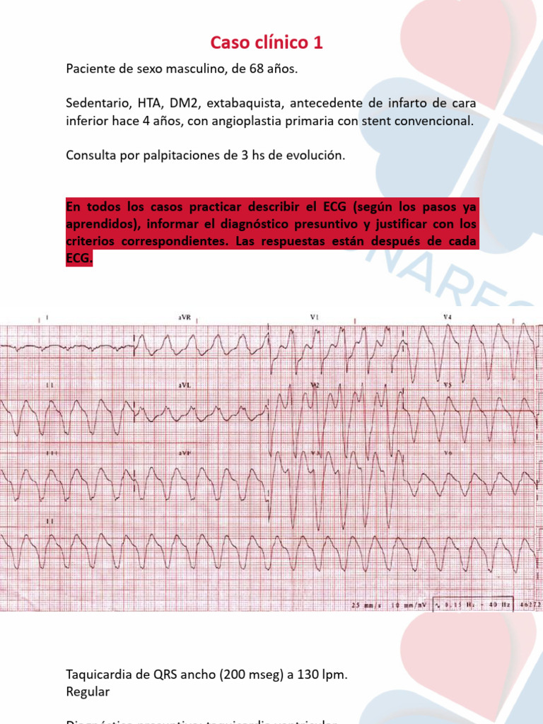 Anexo TP Nâº 7 | PDF | Electrocardiografia | Enfermedades y trastornos