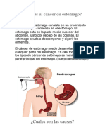 Qué Es El Cáncer de Estómago