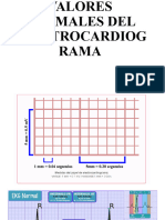 Electrocardiogram A