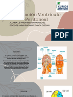Derivación Ventrículo Peritoneal