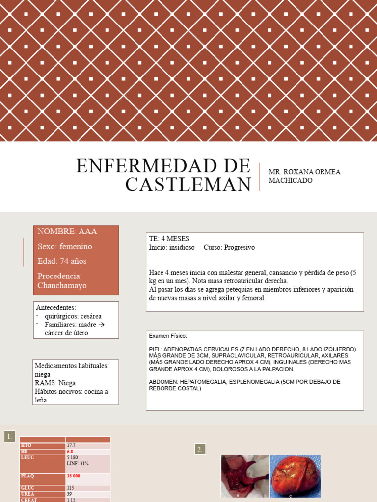 Enfermedad de Castleman: Diagnóstico y Tratamiento | PDF | Medicina ...