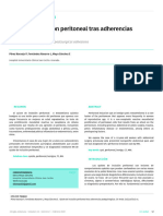 Quiste de Inclusión Peritoneal Tras Adherencias Postquirúrgicas