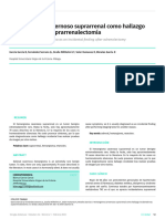 Hemangioma Cavernoso Suprarrenal Como Hallazgo Incidental Tras Suprarrenalectomía