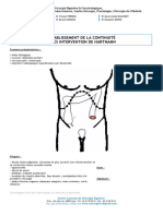 Fiche - Retablissement Continuite Hartmann