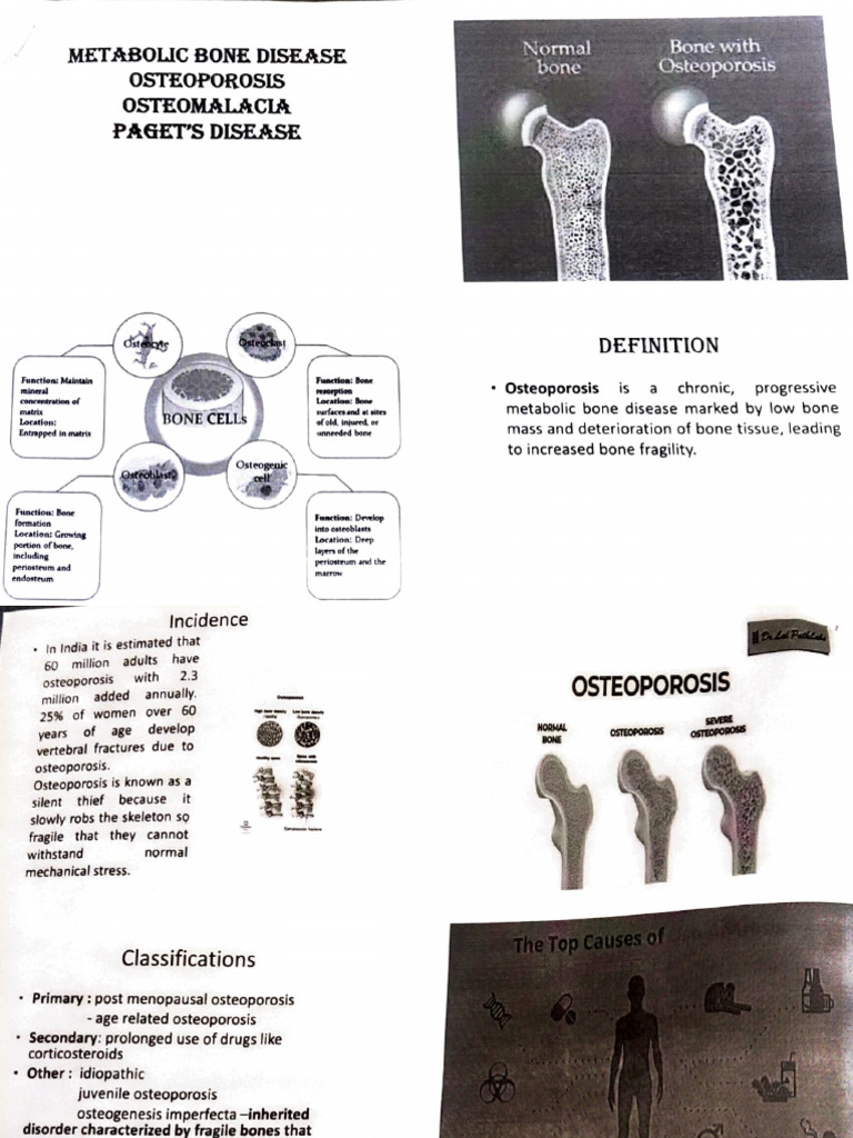 Adobe Scan Apr 22, 2024 (L) | PDF | Bone | Osteoporosis