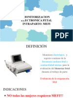 Monitorizacion Fetal 5