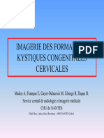 imageries des formations kystiques cervicales congenitales