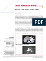 Finasteride Induced Liver Injury A Case Report 8075