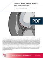 tomsan-et-al-2023-knee-mri-meniscus-roots-ramps-repairs-and-repercussions