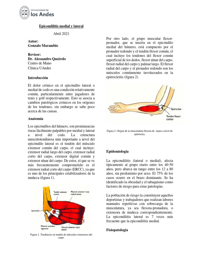 Fisiopatología de la Epicondilitis | PDF | Sistema musculoesquelético ...
