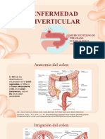 Enfermedad Diverticular