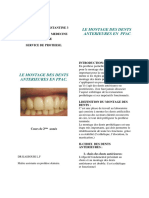 9 Montage Des Dents Anterieures en Ppac - DR Kassouri L.F 1